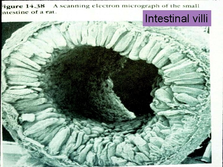 Intestinal villi 