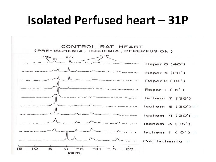 Isolated Perfused heart – 31 P 