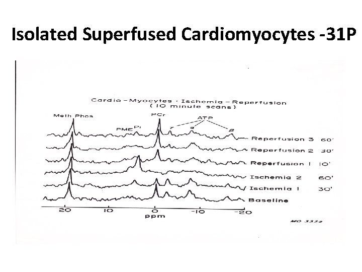 Isolated Superfused Cardiomyocytes -31 P 