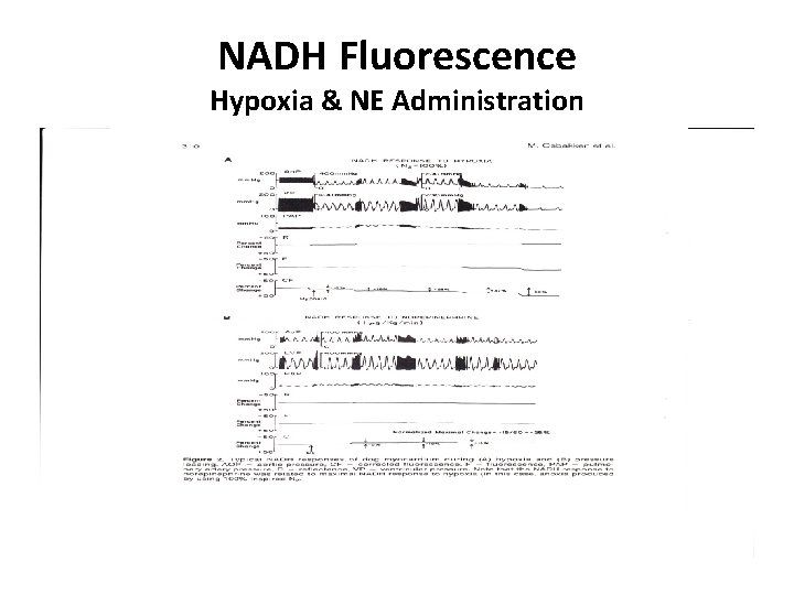 NADH Fluorescence Hypoxia & NE Administration 