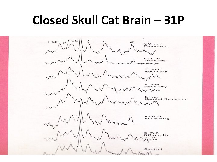Closed Skull Cat Brain – 31 P 