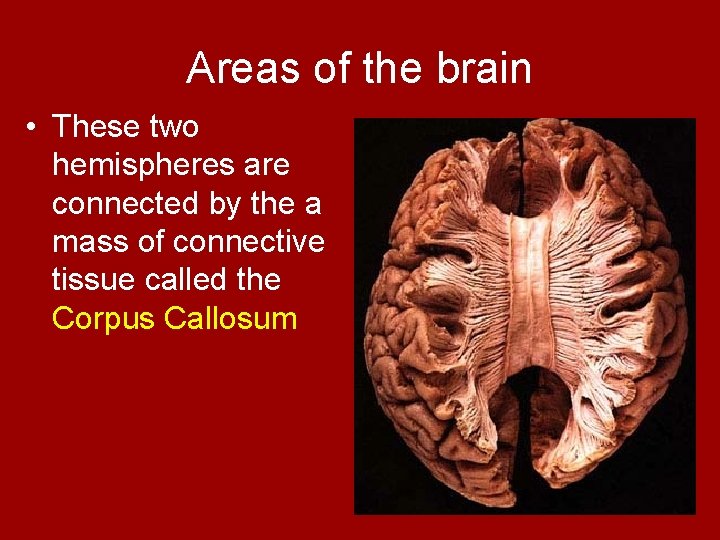 Areas of the brain • These two hemispheres are connected by the a mass