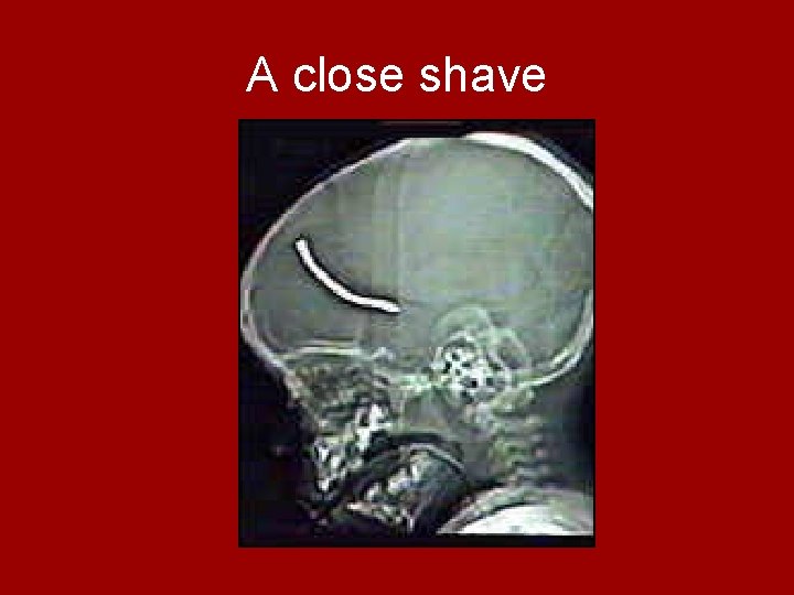 A close shave 