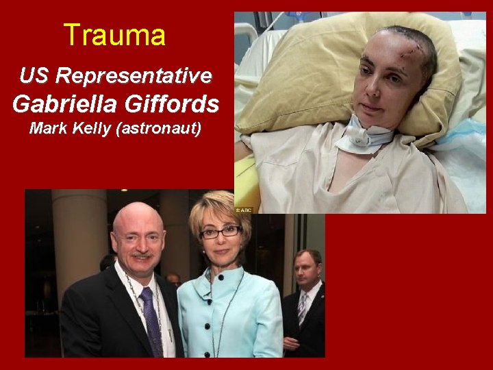 Trauma US Representative Gabriella Giffords Mark Kelly (astronaut) 