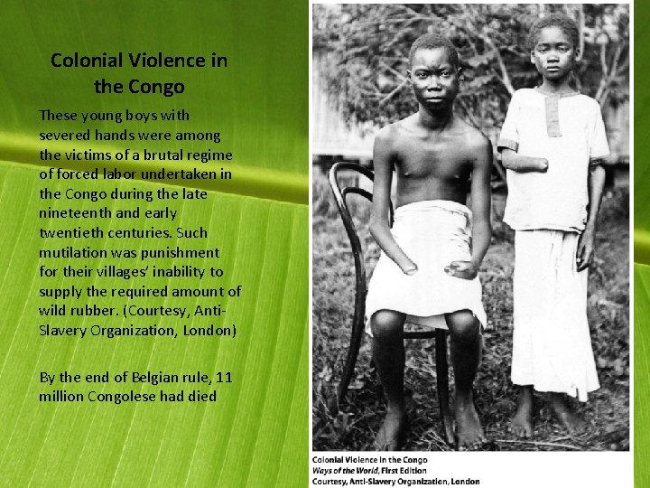 Colonial Violence in the Congo These young boys with severed hands were among the