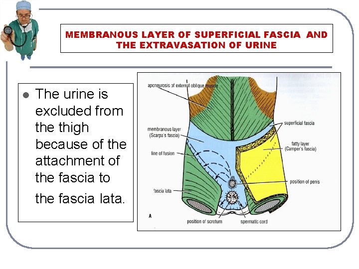 MEMBRANOUS LAYER OF SUPERFICIAL FASCIA AND THE EXTRAVASATION OF URINE l The urine is