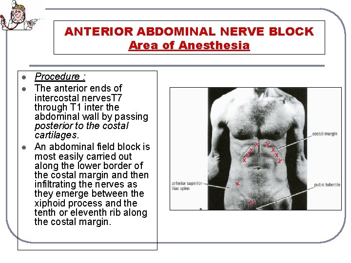 ANTERIOR ABDOMINAL NERVE BLOCK Area of Anesthesia l l l Procedure : The anterior