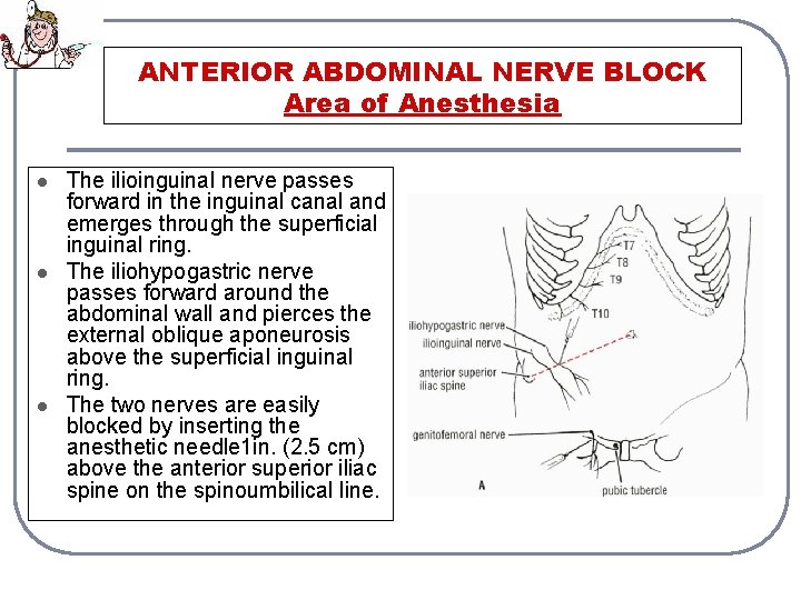 ANTERIOR ABDOMINAL NERVE BLOCK Area of Anesthesia l l l The ilioinguinal nerve passes