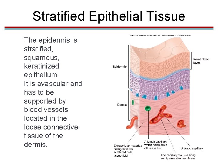Stratified Epithelial Tissue The epidermis is stratified, squamous, keratinized epithelium. It is avascular and Stratified Epithelial Tissue The epidermis is stratified, squamous, keratinized epithelium. It is avascular and