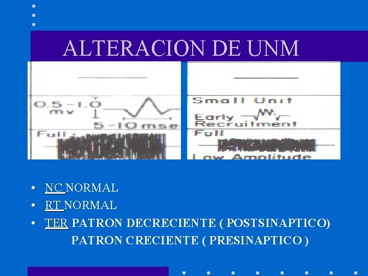 ALTERACION DE UNM • • • NC NORMAL RT NORMAL TER PATRON DECRECIENTE (