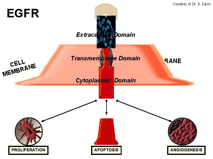 Courtesy of Dr. S. Dacic EGFR Extracellular Domain L CEL NE BRA M E