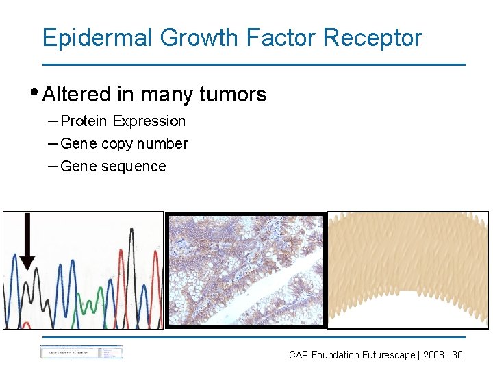 Epidermal Growth Factor Receptor • Altered in many tumors – Protein Expression – Gene