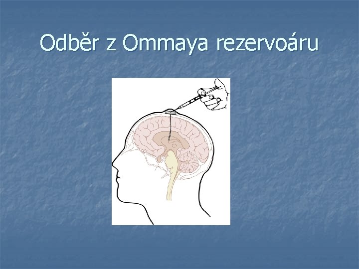 Odběr z Ommaya rezervoáru 