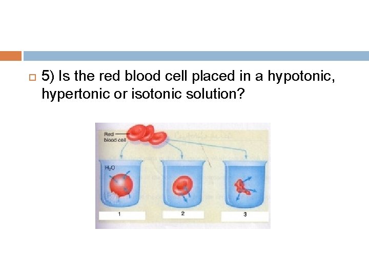  5) Is the red blood cell placed in a hypotonic, hypertonic or isotonic