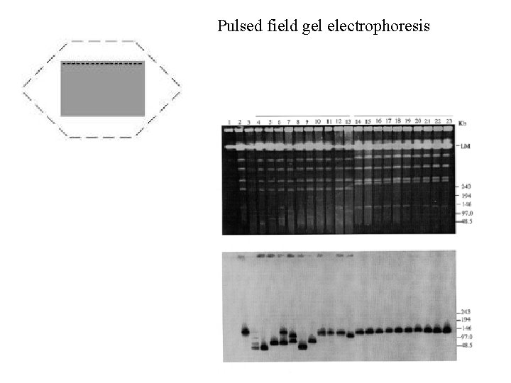 Pulsed field gel electrophoresis 