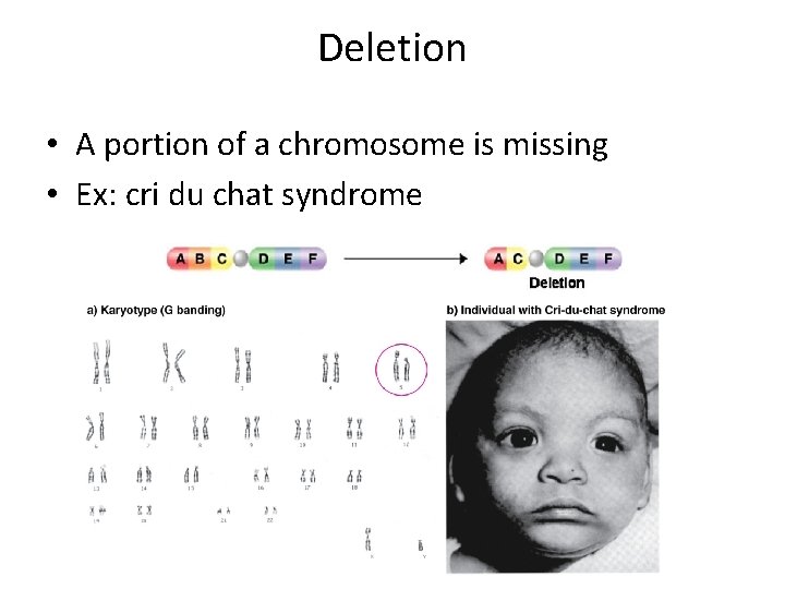 Deletion • A portion of a chromosome is missing • Ex: cri du chat