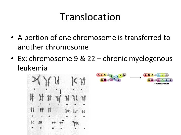 Translocation • A portion of one chromosome is transferred to another chromosome • Ex: