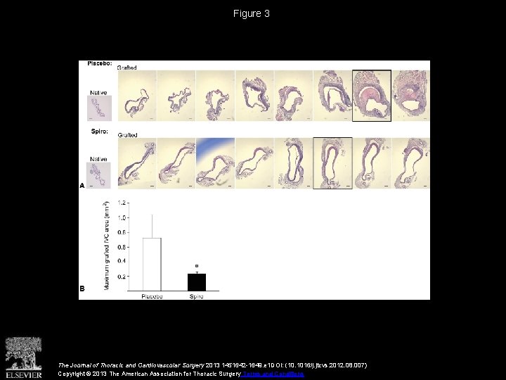 Figure 3 The Journal of Thoracic and Cardiovascular Surgery 2013 1451642 -1649. e 1