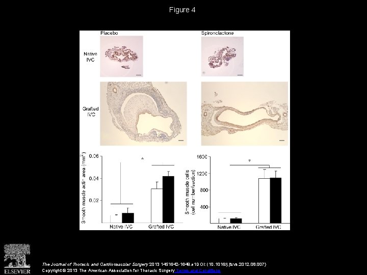 Figure 4 The Journal of Thoracic and Cardiovascular Surgery 2013 1451642 -1649. e 1