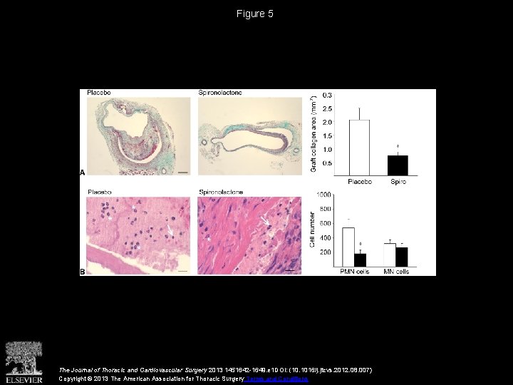 Figure 5 The Journal of Thoracic and Cardiovascular Surgery 2013 1451642 -1649. e 1