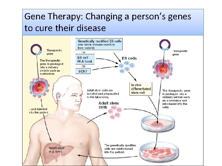 Gene Therapy: Changing a person’s genes to cure their disease 