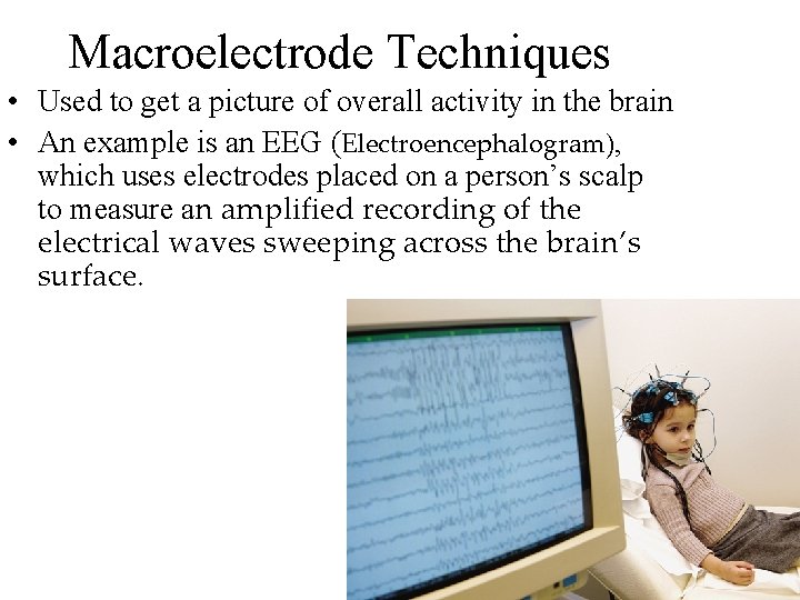 Macroelectrode Techniques • Used to get a picture of overall activity in the brain