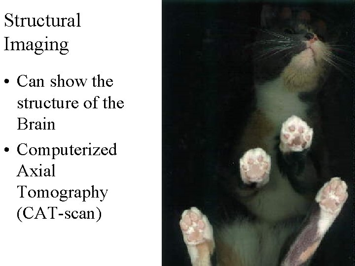 Structural Imaging • Can show the structure of the Brain • Computerized Axial Tomography