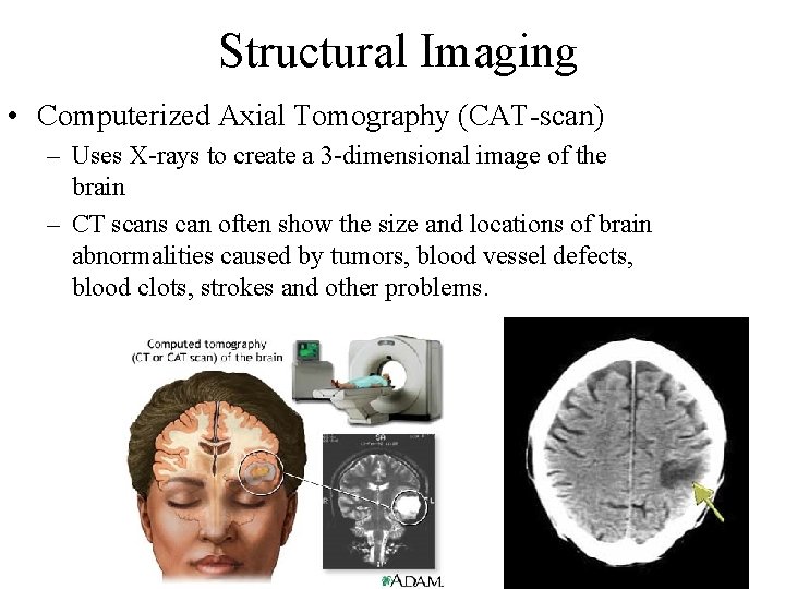 Structural Imaging • Computerized Axial Tomography (CAT-scan) – Uses X-rays to create a 3