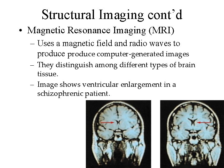 Structural Imaging cont’d • Magnetic Resonance Imaging (MRI) – Uses a magnetic field and