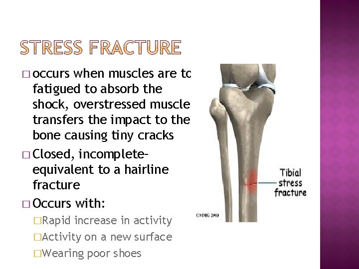 � occurs when muscles are too fatigued to absorb the shock, overstressed muscle transfers