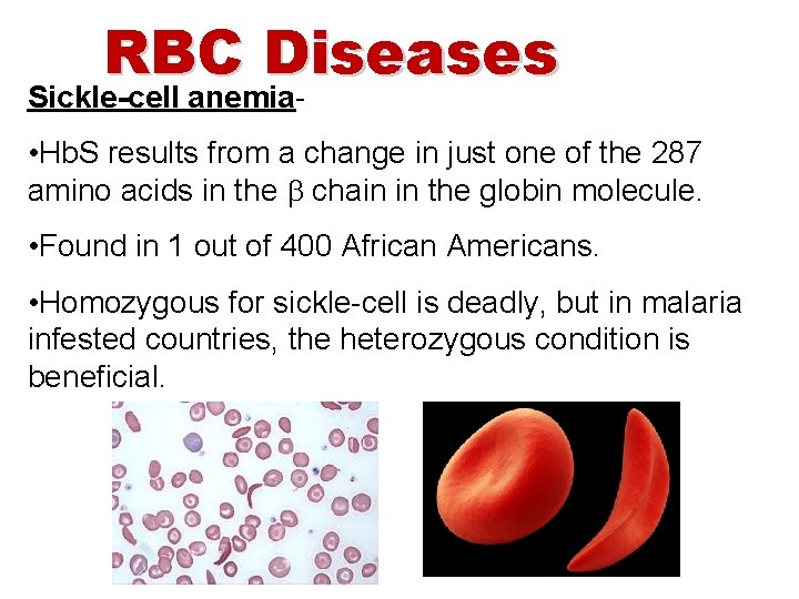 RBC Diseases Sickle-cell anemia- • Hb. S results from a change in just one