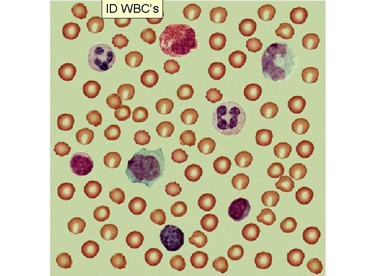 ID WBC’s 