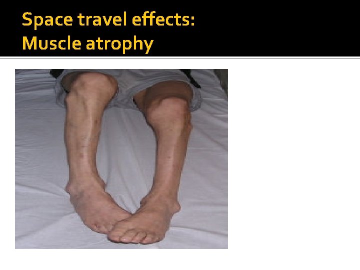Space travel effects: Muscle atrophy 