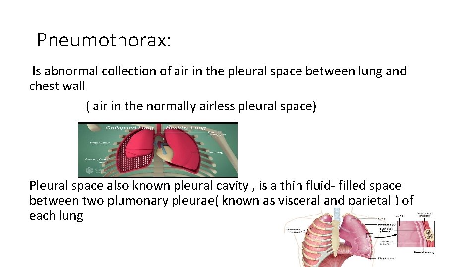 Pneumothorax: Is abnormal collection of air in the pleural space between lung and chest