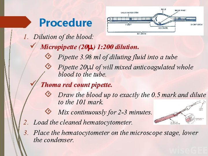 Procedure 1. Dilution of the blood: ü Micropipette (20 ) 1: 200 dilution. Pipette