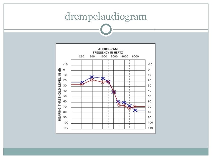 drempelaudiogram 