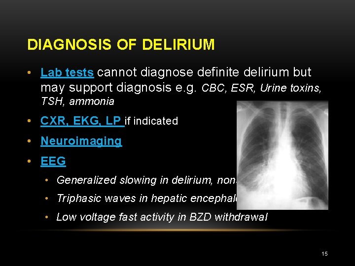 DIAGNOSIS OF DELIRIUM • Lab tests cannot diagnose definite delirium but may support diagnosis
