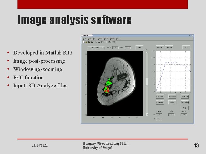Image analysis software • • • Developed in Matlab R 13 Image post-processing Windowing-zooming