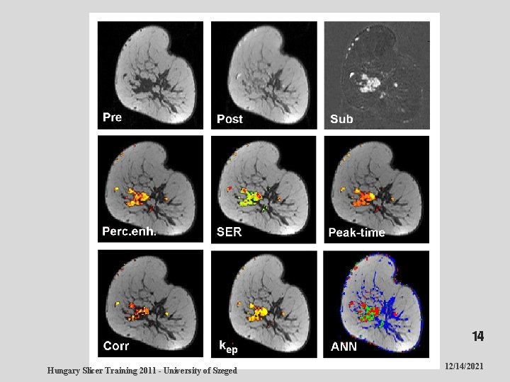 14 Hungary Slicer Training 2011 - University of Szeged 12/14/2021 
