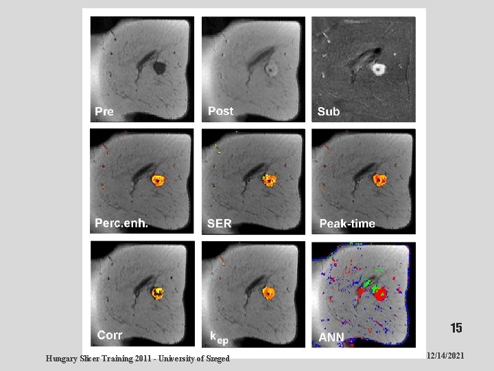 15 Hungary Slicer Training 2011 - University of Szeged 12/14/2021 