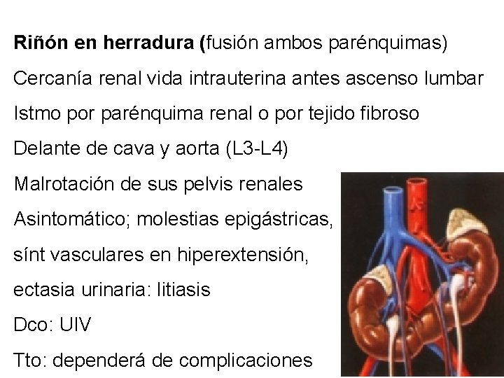Riñón en herradura (fusión ambos parénquimas) Cercanía renal vida intrauterina antes ascenso lumbar Istmo