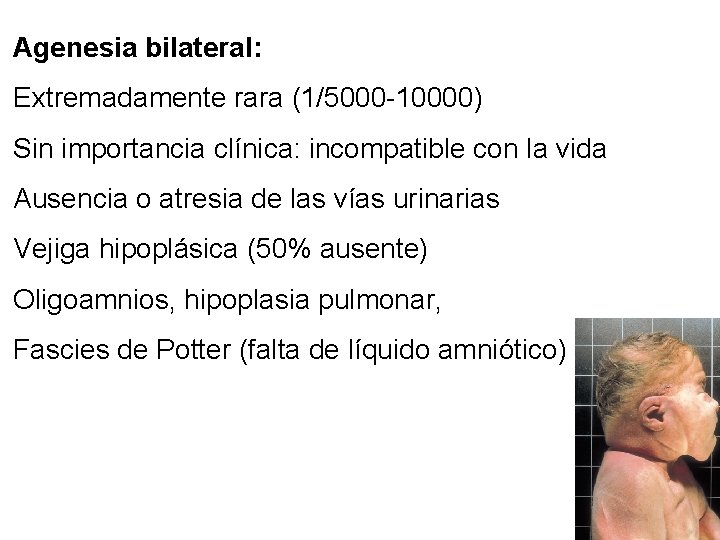 Agenesia bilateral: Extremadamente rara (1/5000 -10000) Sin importancia clínica: incompatible con la vida Ausencia