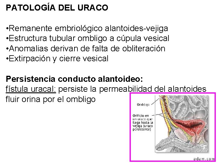 PATOLOGÍA DEL URACO • Remanente embriológico alantoides-vejiga • Estructura tubular ombligo a cúpula vesical