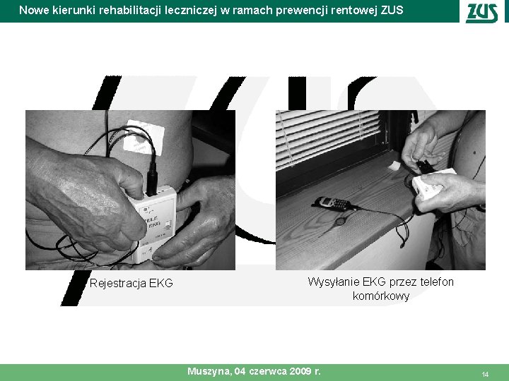 Nowe kierunki rehabilitacji leczniczej w ramach prewencji rentowej ZUS Rejestracja EKG Wysyłanie EKG przez