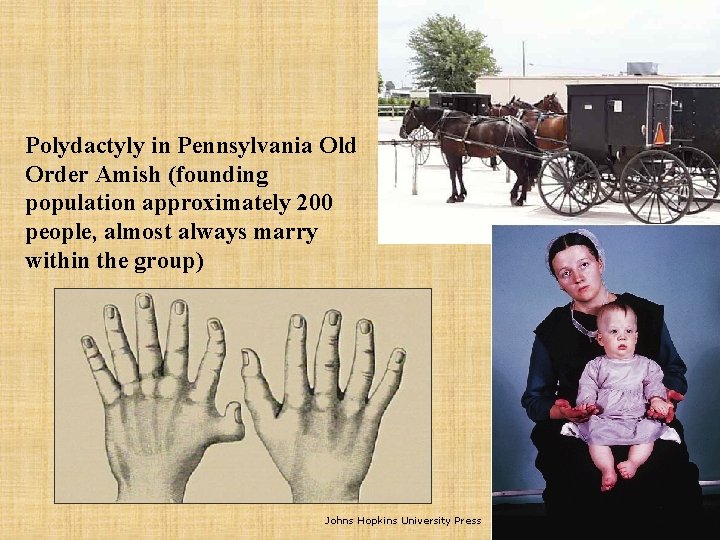 Polydactyly in Pennsylvania Old Order Amish (founding population approximately 200 people, almost always marry