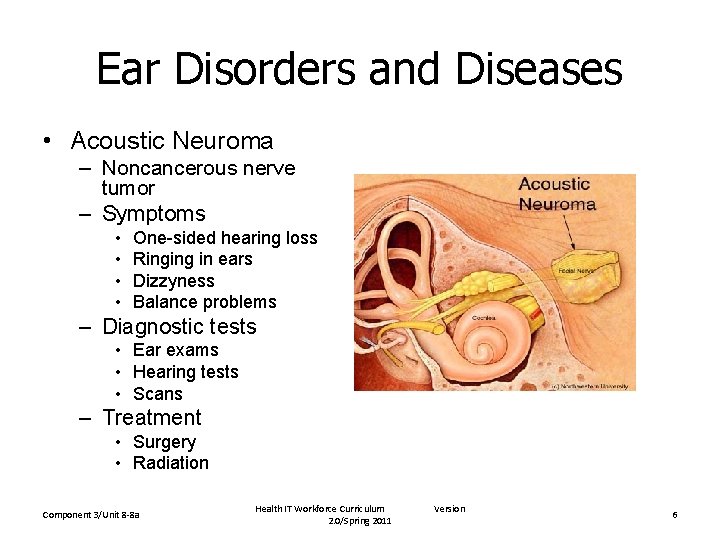 Ear Disorders and Diseases • Acoustic Neuroma – Noncancerous nerve tumor – Symptoms •