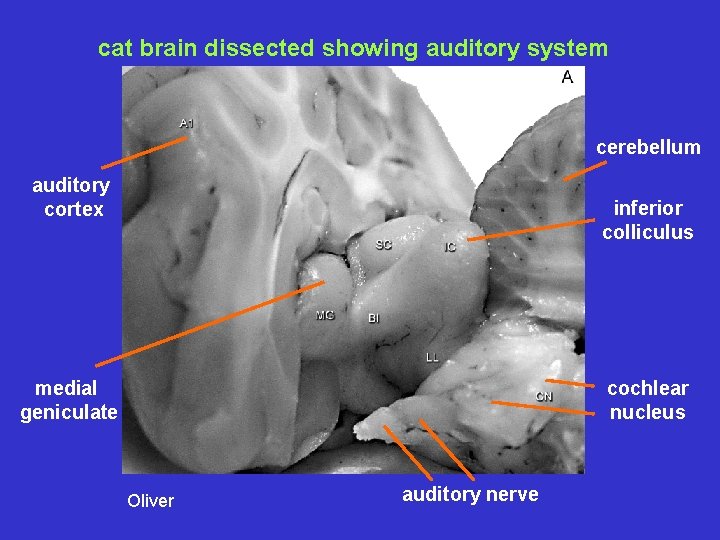 cat brain dissected showing auditory system cerebellum auditory cortex inferior colliculus medial geniculate cochlear