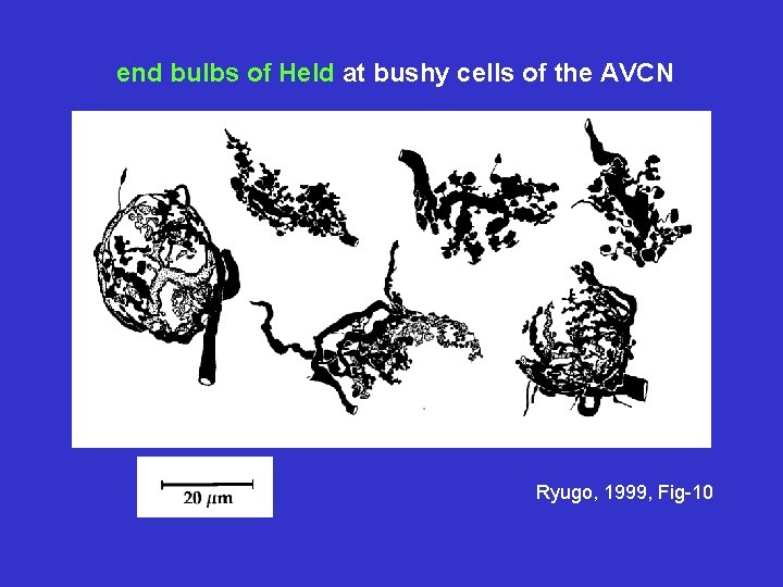 end bulbs of Held at bushy cells of the AVCN Ryugo, 1999, Fig-10 