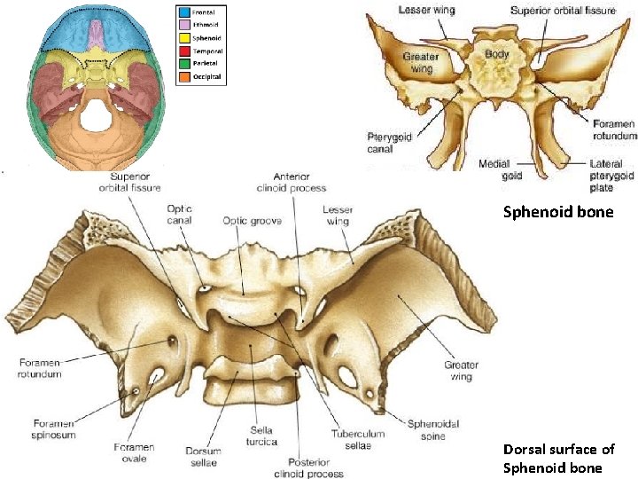 Sphenoid bone Dorsal surface of Sphenoid bone 