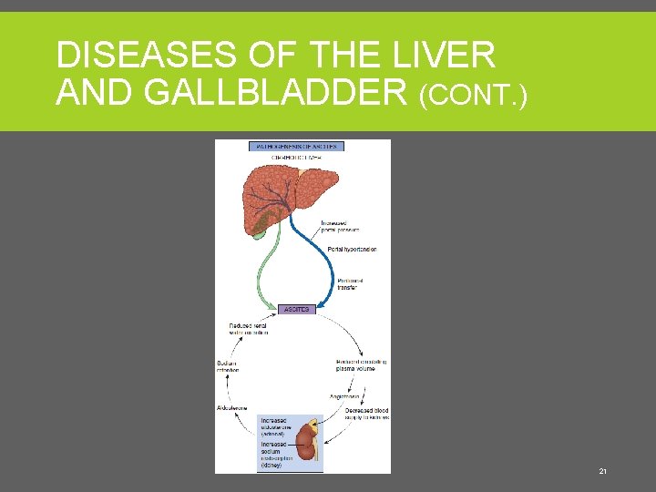 DISEASES OF THE LIVER AND GALLBLADDER (CONT. ) 21 